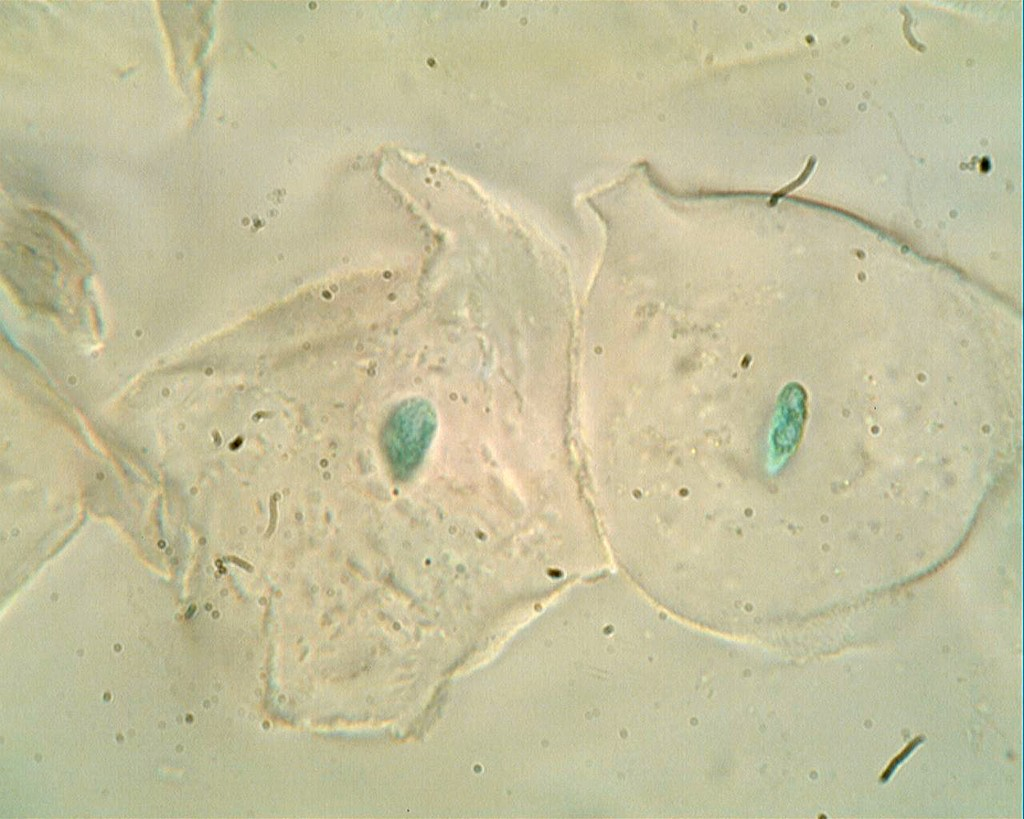 Sch ma Cellule Buccale Cellule Buccale Def EVUEL Sch ma Cellule Buccale Cellule Buccale Def EVUEL